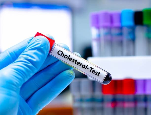 Skip the Fast: Modern Cholesterol Testing is Here!